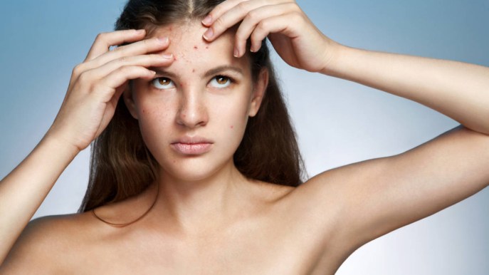 Skin Shaming: l’odio che corre sulla pelle è il nuovo dilagante fenomeno web