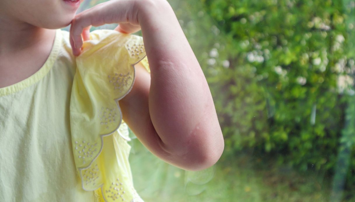 Kit per incidenti bambini