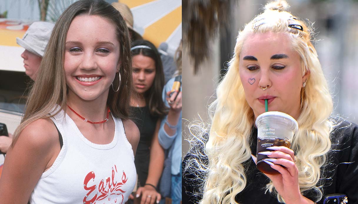 Amanda Bynes ieri e oggi