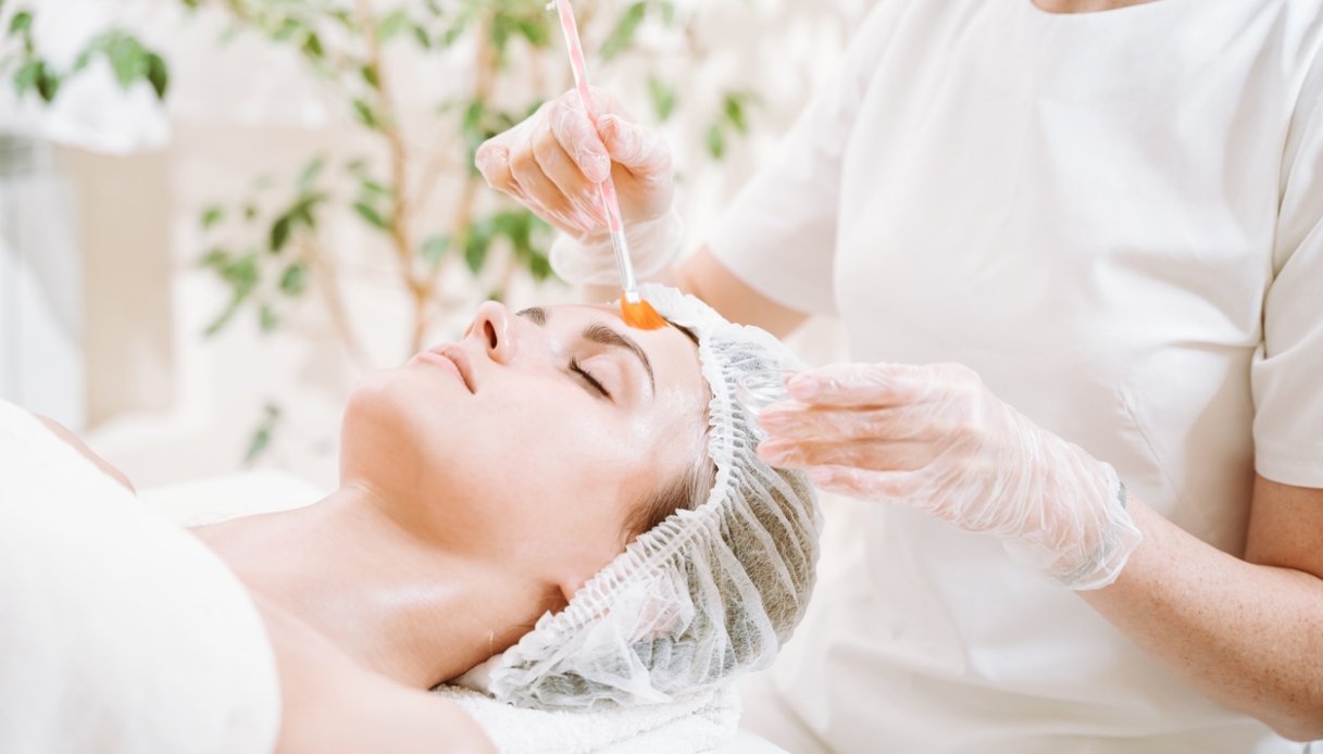 Trattamenti estetici viso, il peeling chimico