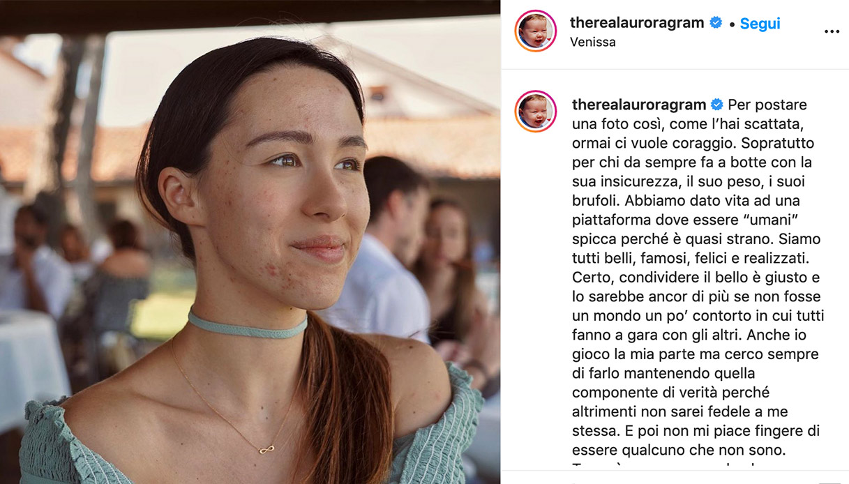 Aurora Ramazzotti