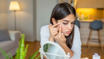 Acne: 7 errori da non commettere per una pelle più sana e bella