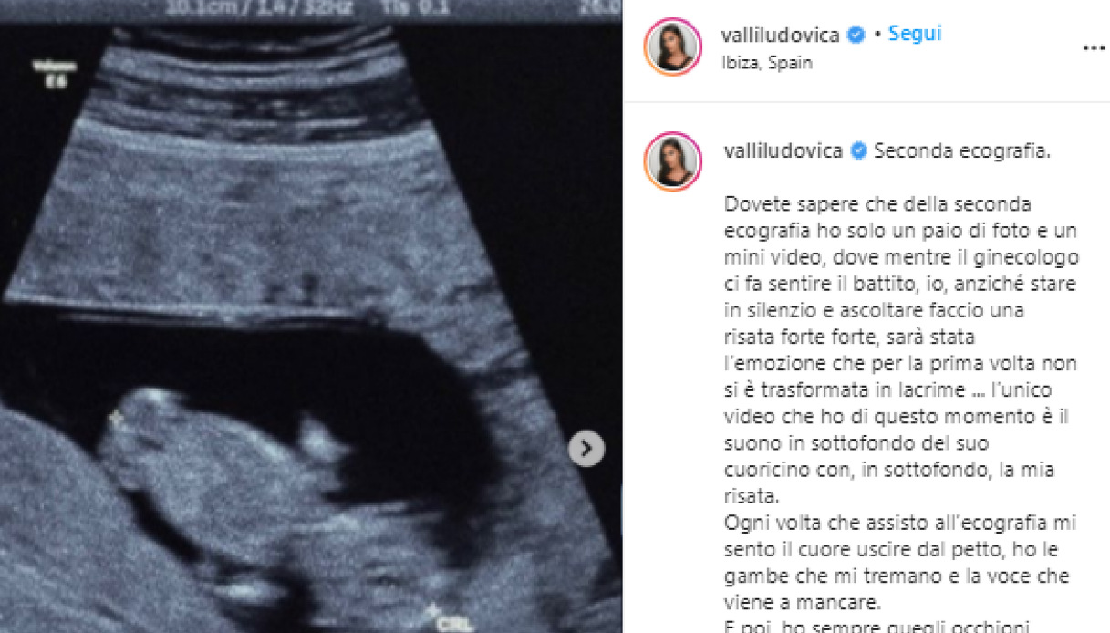 ludovica-valli-ecografia
