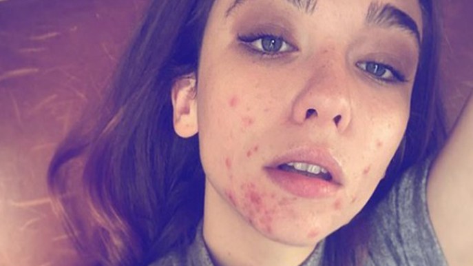 Matilda De Angelis: “Fiera delle mie cicatrici. Non mi importa essere bella”
