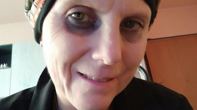 L’appello di Daniela è stato ascoltato: sua madre l’aiuterà nella lotta contro il cancro