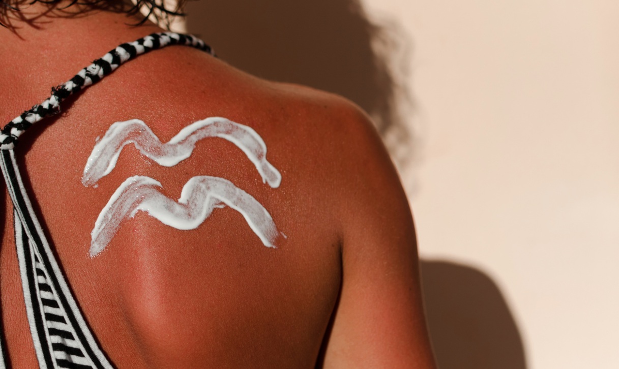 Non spellarsi dopo una scottatura con la crema solare