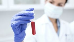 Leucemia mieloide acuta, come si riconosce e si affronta