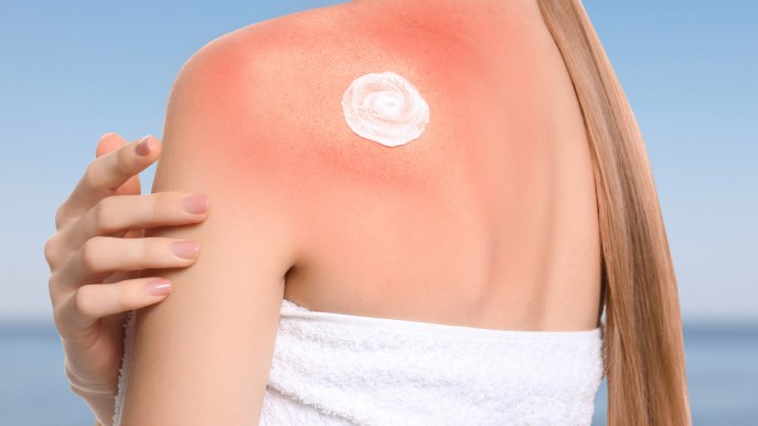 Estate, le regole di prevenzione per chi soffre di allergia cutanea