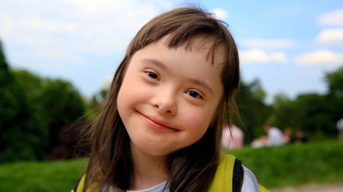 Sindrome di Down: come si riconosce e quali sono le cause