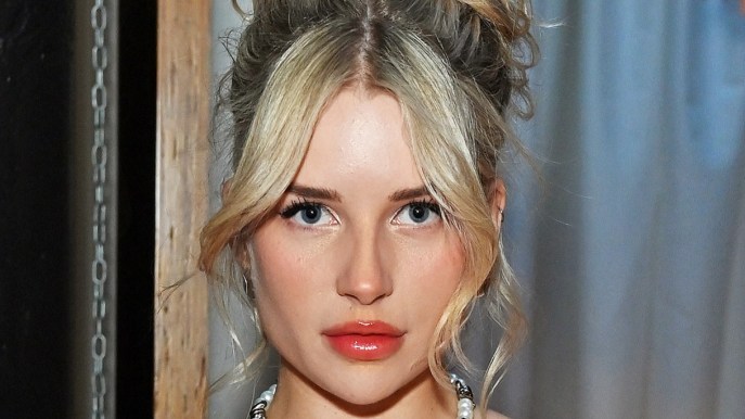 Lottie Moss, brutto risveglio per la sorella di Kate: cos’è successo al suo viso
