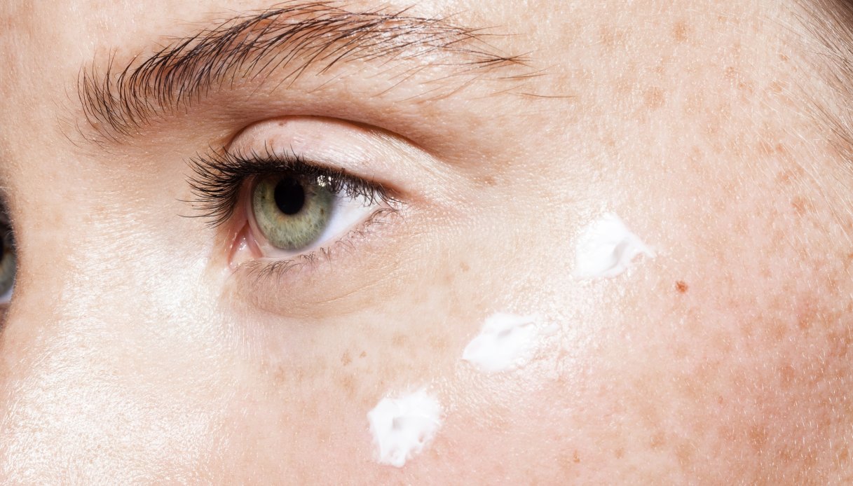Primo piano di una donna con pelle molto chiara con lentiggini con focus sull'occhio verde di lato con della crema bianca applicata poco sotto