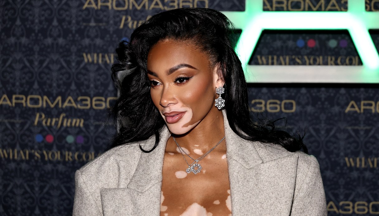 La modella cin vitiligine Winnie Harlow sun red carpet indossa una giacca beige e orecchini e collana di diamanti, e porta i capelli sciolti spostati lateralmente