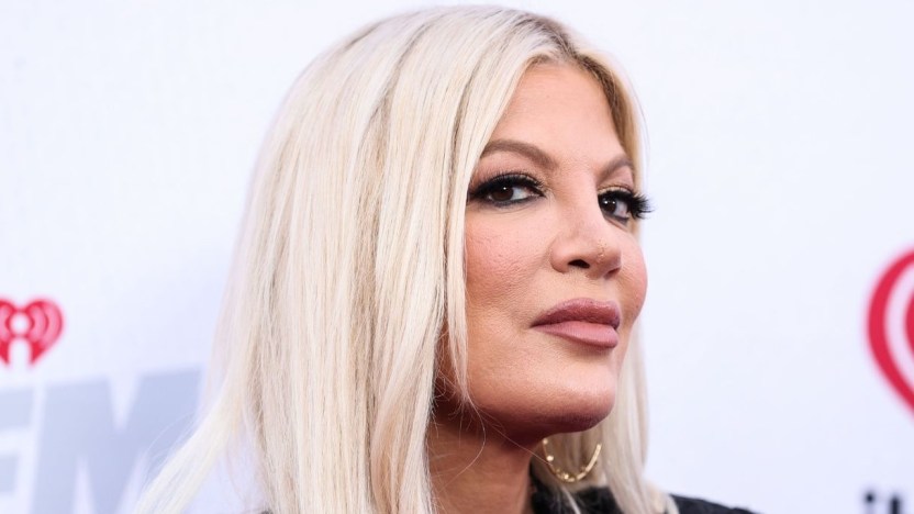 Preoccupazione per Tori Spelling: il ricovero in ospedale e i lividi sul volto
