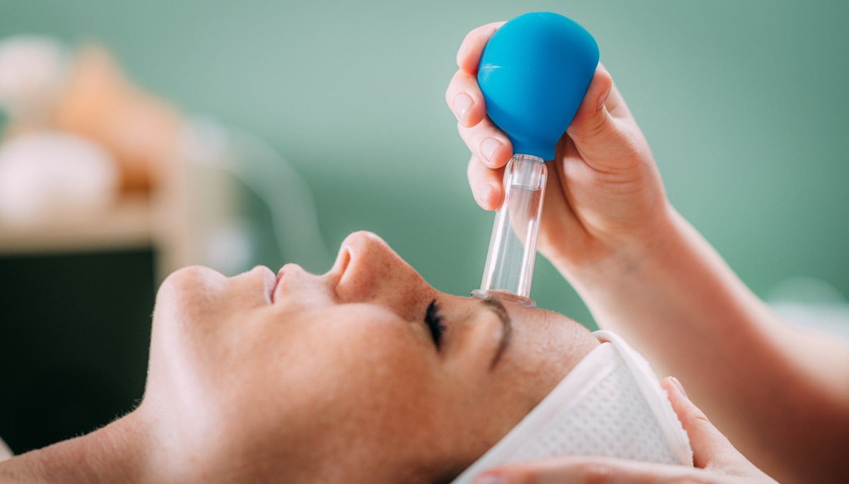 Cupping therapy, ventosa cupping face treatment in a beauty salon