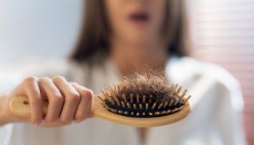 Alopecia: cause, prevenzione, come curarla