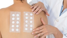 Patch test epicutanei: cosa sono, a cosa servono
