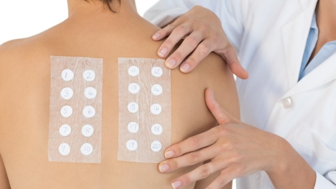 Patch test epicutanei: cosa sono, a cosa servono