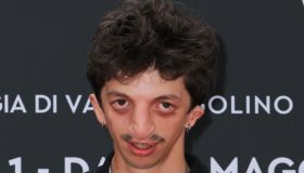 Chi è Giovanni Bagnasco, l’attore scelto da Valeria Golino con la sindrome di Treacher Collins